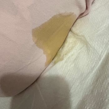 Molfix Bezleri Sızdırıyor: Bebekler İçin Güvenli Mi?