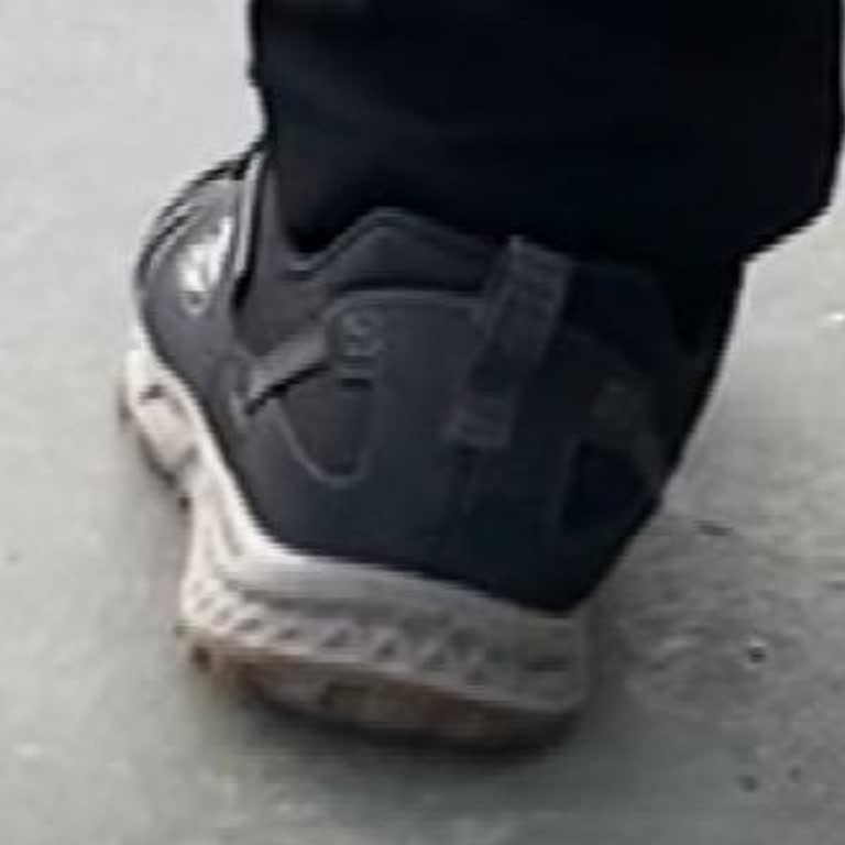 Skechers Ayakkabıda Üretim Hatası Ve İlgisiz İnceleme Süreci