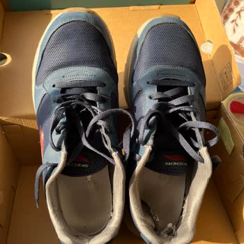 Skechers Ayakkabıda Kalitesiz Malzeme Sorunu