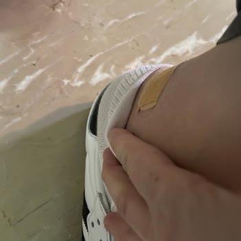 Adidas Ayakkabı Ayağımı Yaraladı