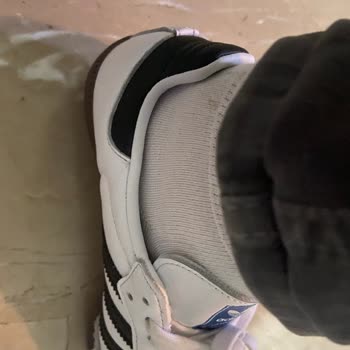 Adidas Ayakkabı Ayağımı Yaraladı