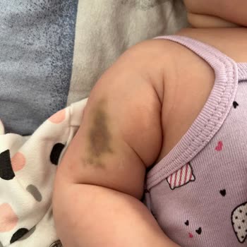 Yanlış Doz İlaç Ve Hastane Kabusu