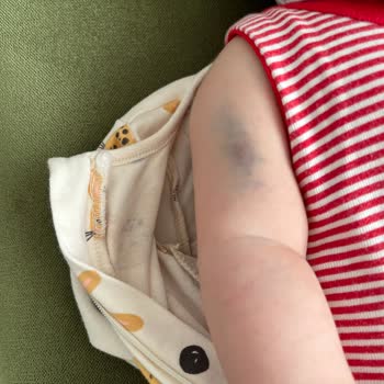 Yanlış Doz İlaç Ve Hastane Kabusu