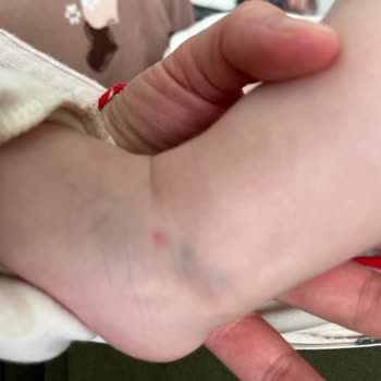 Yanlış Doz İlaç Ve Hastane Kabusu