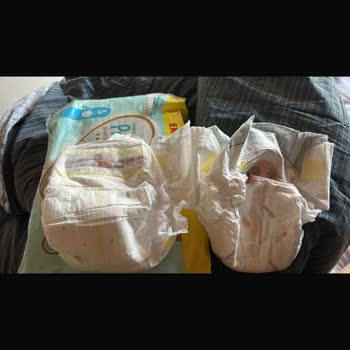 A101 Kapıda Uygulamasında Eski Tarihli Ve Farklı Prima Bez Sorunu