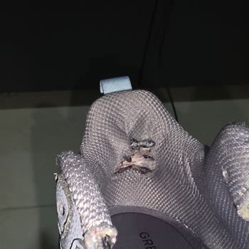 Ayakkabının Ayağımı Yaralaması Ve Deformasyon Sorunu