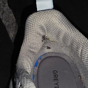 Ayakkabının Ayağımı Yaralaması Ve Deformasyon Sorunu