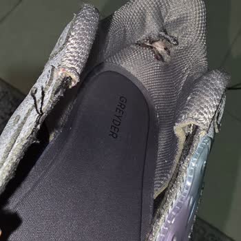 Ayakkabının Ayağımı Yaralaması Ve Deformasyon Sorunu