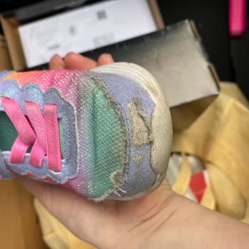 Skechers Ayakkabıda Kalite Hayal Kırıklığı: Müşteri Memnuniyeti Arayışı