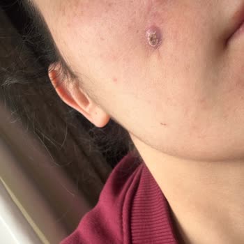 Prof. Dr. Birol Civelek Yüzüm Eski Halinden Kötü Durumda