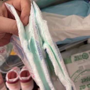 Molfix Bebek Bezi Tasarım Sorunları