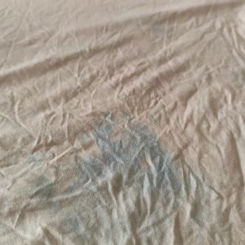 Dr. Beckmann Leke Çıkarıcı Giysilerimi Mahvetti