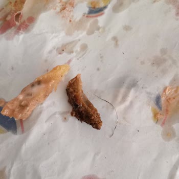 Yemek Sepeti'nde Hijyen Sorunu Ve İlgisizlik