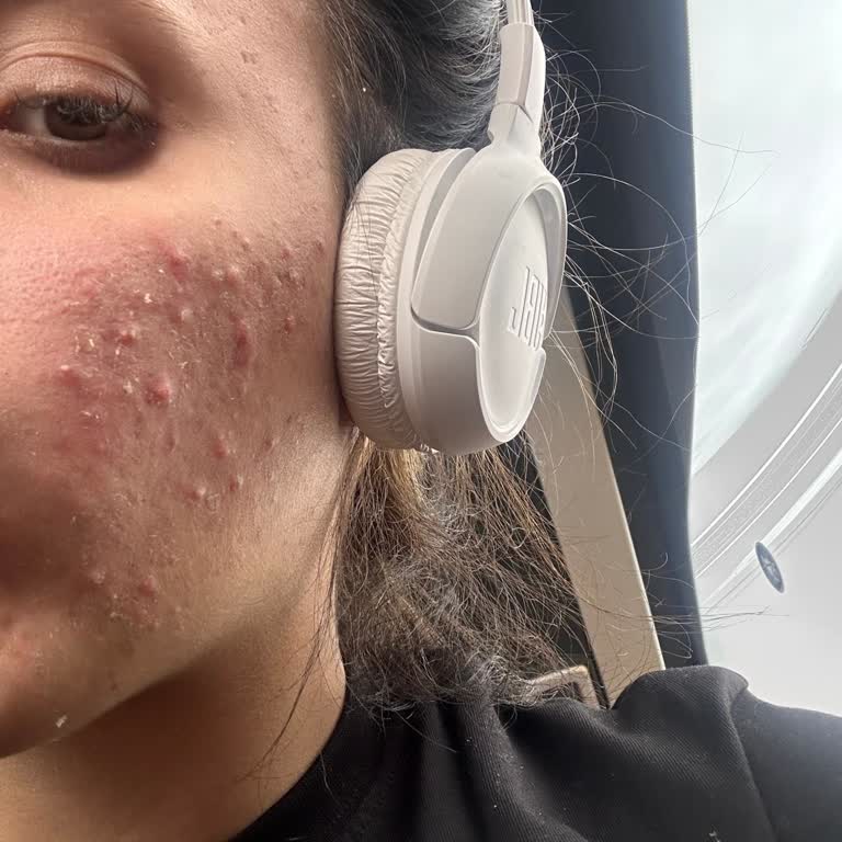 Aris Güzellik Merkezleri Cilt Seanslarında Hayal Kırıklığı Ve Yanıltıcı Uygulamalar!