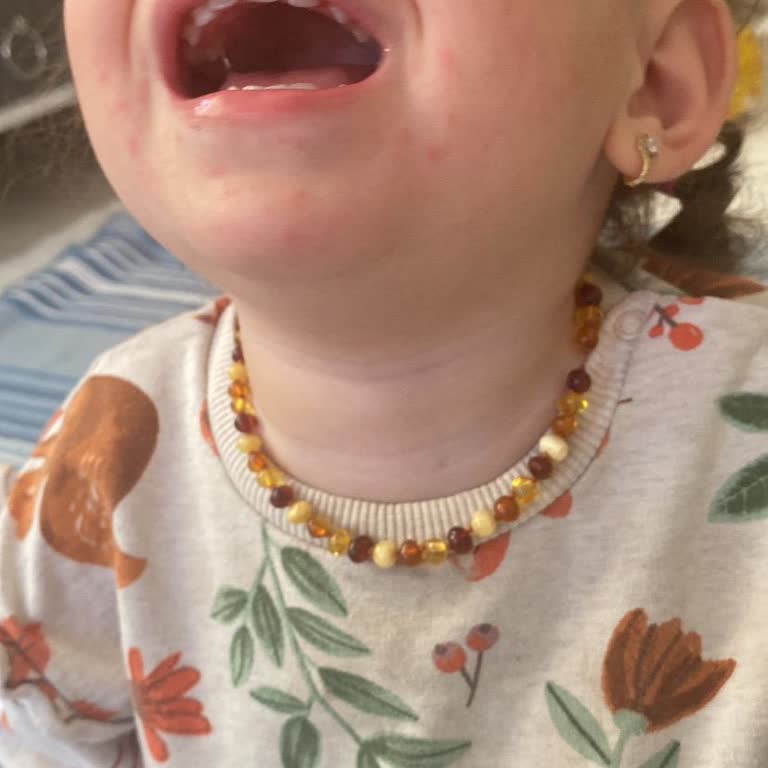 Çocuğumun Sağlığı Tehlikede: Yan Etkilerle Karşılaştık!