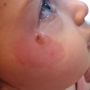 Mustela Arnica Jel Kalitesizliği