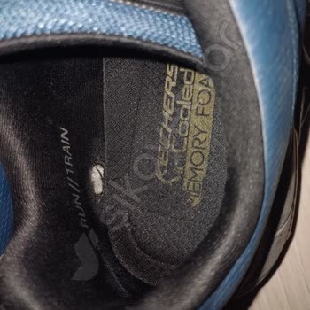 Skechers Ayakkabıda 8 Ayda Şaşırtan Deformasyon