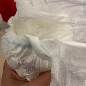 Molfix Bebek Bezi: Hayal Kırıklığı Ve Cilt Sorunları