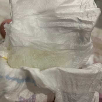 Molfix Bebek Bezi: Hayal Kırıklığı Ve Cilt Sorunları