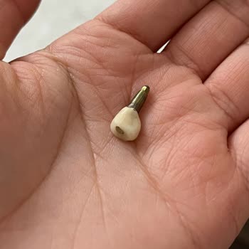 Rota Dent Adsp Saygısız Diş Hekimi Ve Personellerle Dolu Bir Yer