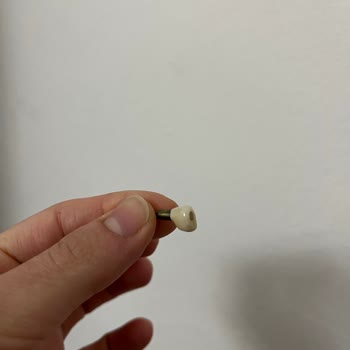 Rota Dent Adsp Saygısız Diş Hekimi Ve Personellerle Dolu Bir Yer