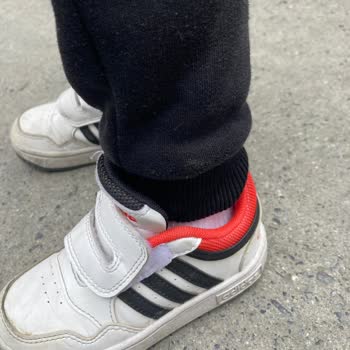 Adidas Ayakkabının Cırt Cırt Sorunu