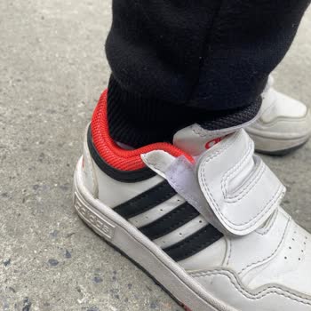 Adidas Ayakkabının Cırt Cırt Sorunu