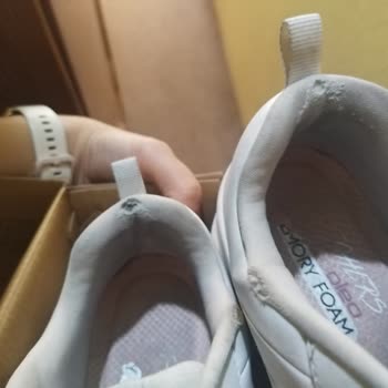 Skechers Ayakkabıda 2 Ayda Deformasyon Ve Müşteri Hizmetleri Hayal Kırıklığı