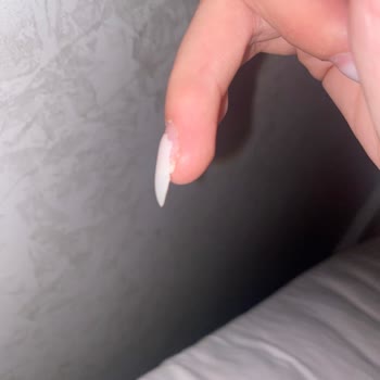 Hijyen Sorunu Ve Kötü Hizmet: Tırnak Bakımında Felaket