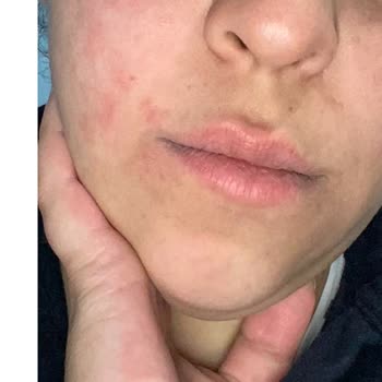 Cilt Ürününde Büyük Hayal Kırıklığı