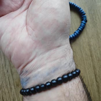 Renk Veren Bileklik Sorunu