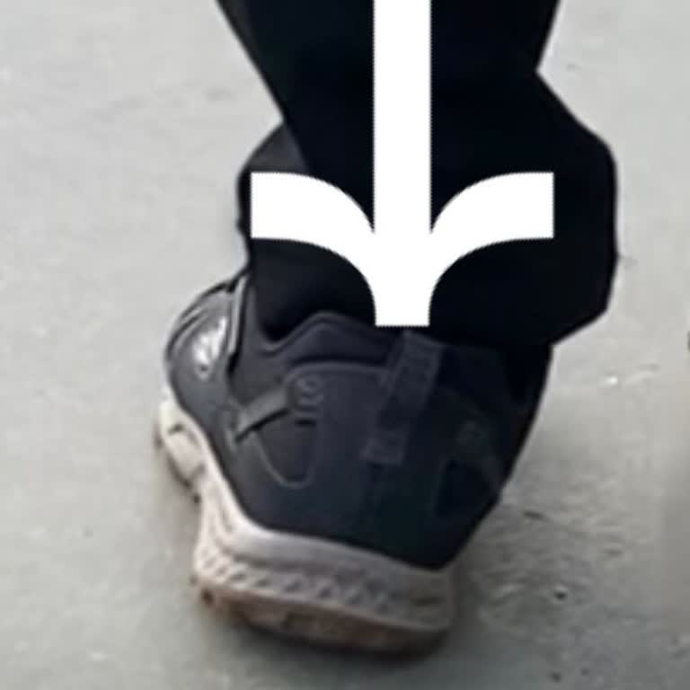 Skechers Ayakkabıda Üretim Hatası Ve Müşteri Hizmetleri Sorunu