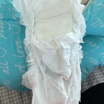 Goon Bebek Bezinde Kalite Sorunu Ve İletişim Eksikliği