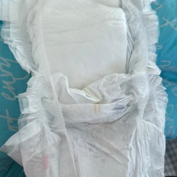 Goon Bebek Bezinde Kalite Sorunu Ve İletişim Eksikliği