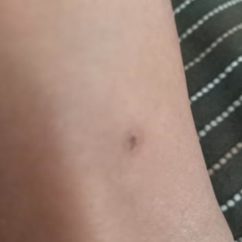 Boyner'den Aldığım Botlar Bileklerimi Yaraladı