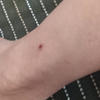 Boyner'den Aldığım Botlar Bileklerimi Yaraladı