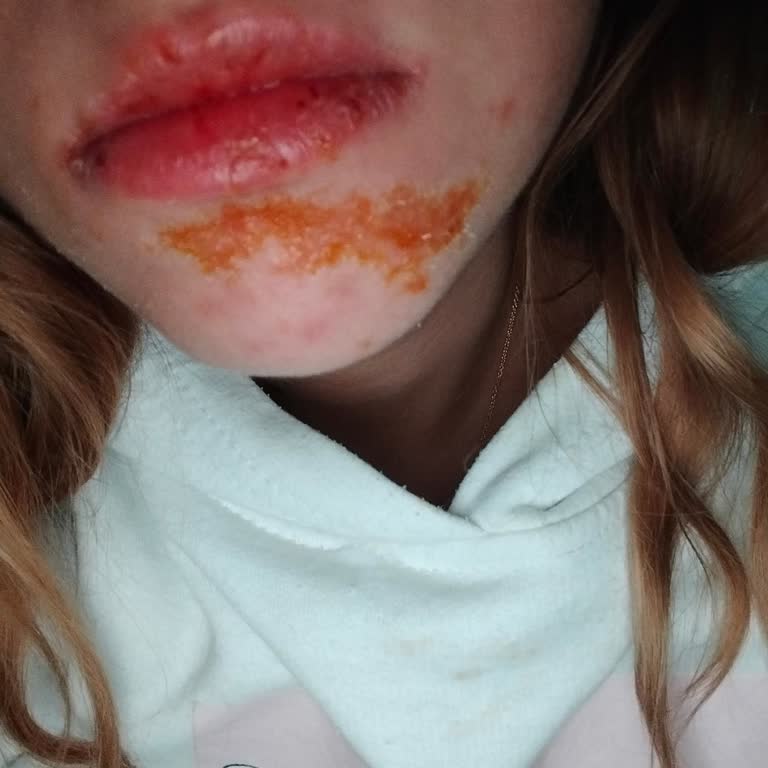 Cilt Tedavisinde İlgisizlik Ve Kabalık