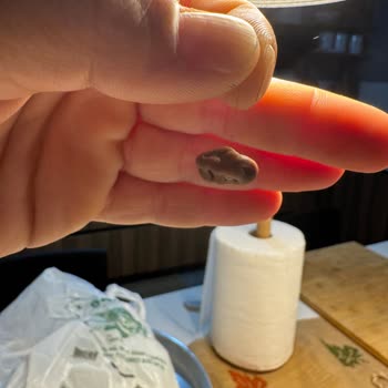 Çikolata Paketinden Çıkan Kıl Şoku