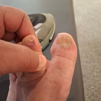 SuperStep Ayakkabı İade Sürecinde Müşteri Memnuniyetsizliği