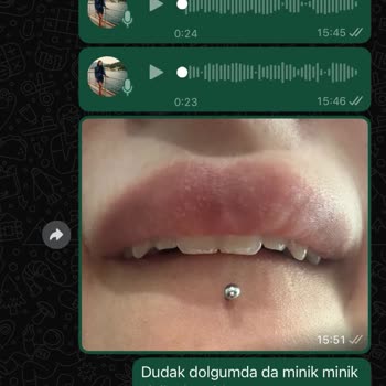 Estetik İşlemlerde Başarısız Sonuç Ve İletişim Sorunları