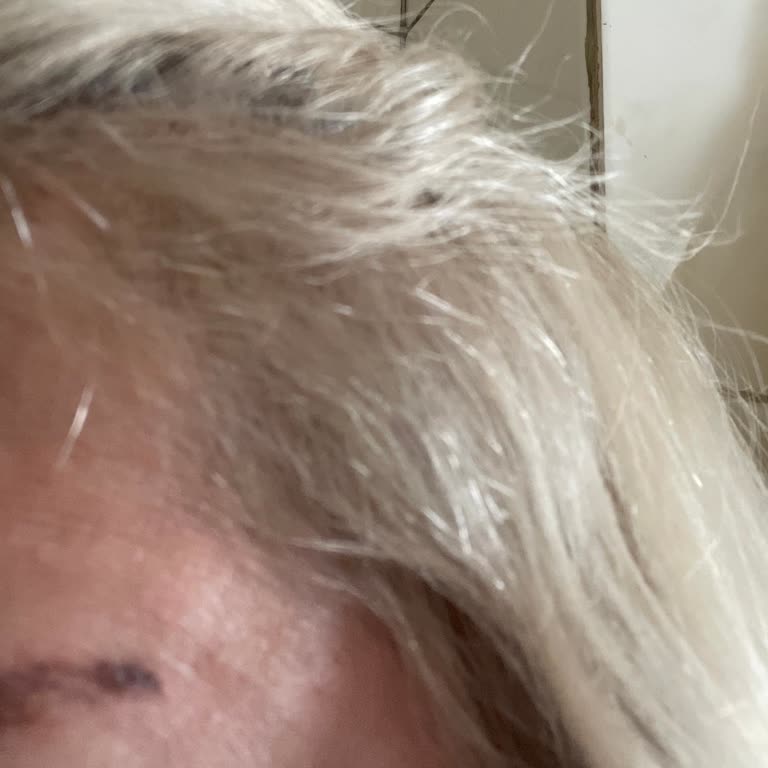 Damla Arı & Gizem Albayrak Beauty Stüdyo Yapılan Başarısız İşlemler