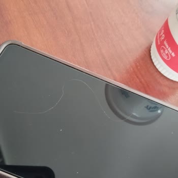 BİM Marketten Aldığım Çiğköftede Şok Edici Yabancı Madde