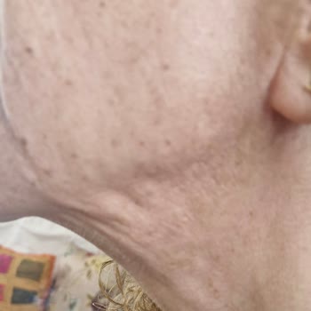 Başarısız Estetik Operasyon Ve Yanıltıcı Bilgilendirme