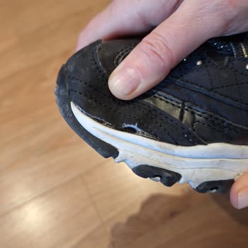 Skechers Ayakkabıda Erken Yırtılma Ve İade Sorunu