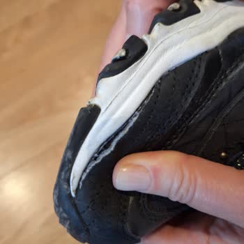 Skechers Ayakkabıda Erken Yırtılma Ve İade Sorunu