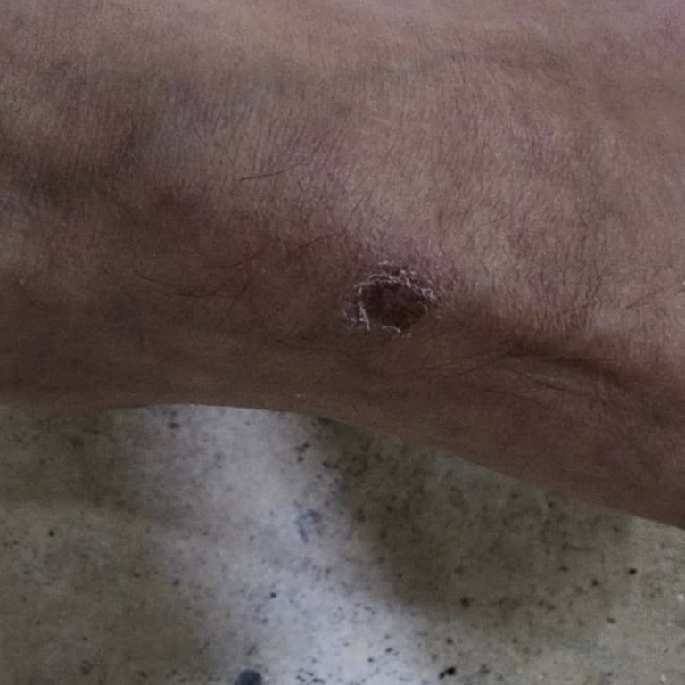 Nike Mağazasından Alınan Ayakkabının Dikiş Hatası Ve Müşteri Hizmetleri Sorunu