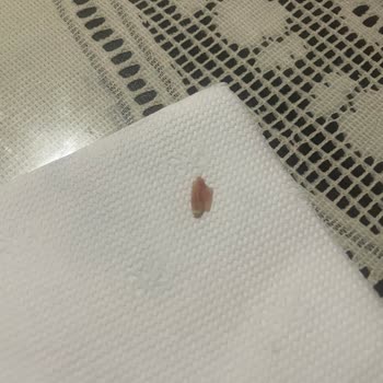 Ton Balığında Kılçık Ve Yüzgeç Parçası Şoku