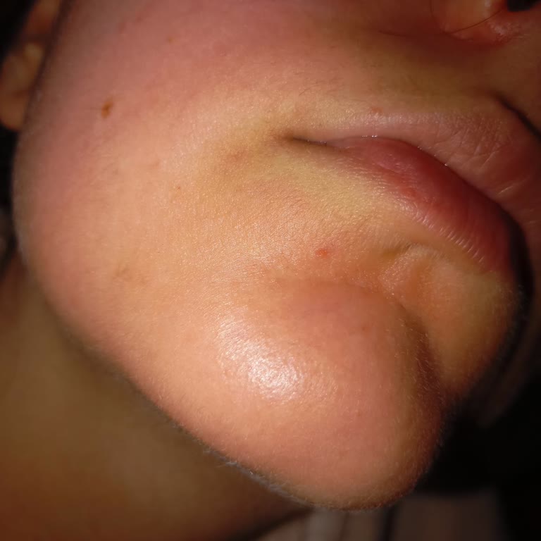 Cream Co Nemlendirici Yüzde Tahriş Ve Yanma Yapıyor