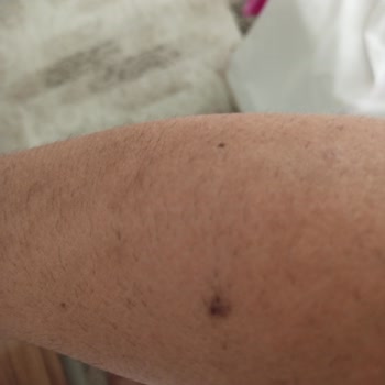 Bercislina'da Hayal Kırıklığı: Beklenen Sonuç Alınamadı