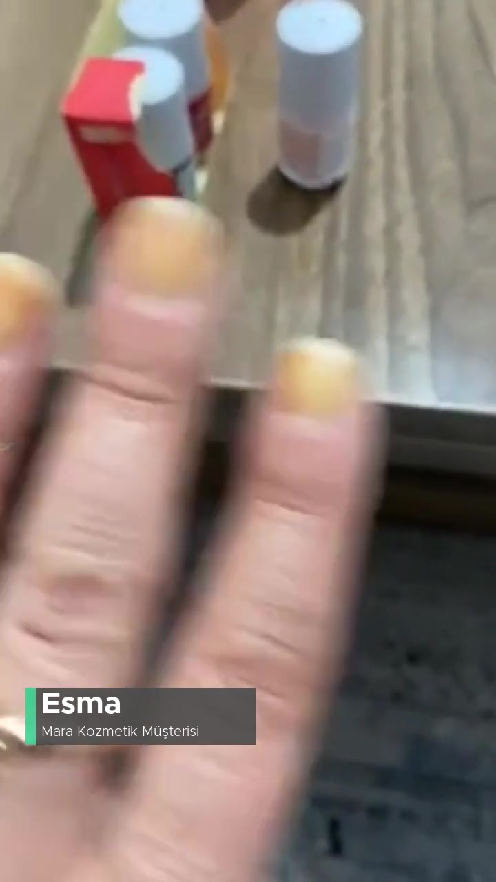 Mara Oje Tırnaklarıma Kalıcı Hasar Verdi videonun kapak resmi